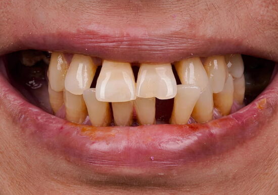 Before - The Houston Group